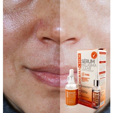 Sérum Clareador Facial